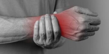 Carpal Tunnel Syndrome – strengthening exercises to improve recovery results.